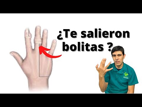 Nódulos en los dedos de las manos: dolor, inflamación, tumefacción y rigidez
