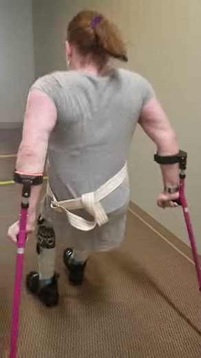 PT with the HKAFO braces - Hallway part 2 of 2