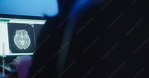 Reveal Double MRI Head Scans on Laptop Medium Pan Left. view pans left and reveals a person looking at a laptop with two mri head scans