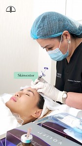 DKC Barbie Forehead is a Non-surgical forehead reshaping that Restores balance and harmony to the face, the Barbie Forehead procedure focuses on the forehead, using Hyaluronic Acid fillers to either augment or enhance the shape and volume of the forehead. This procedure is done with DKC bespoke technique that can subtly, but noticeably reshape the forehead, addressing multiple issues for those who are looking to restore balance out to their features. 💆🏻‍♀️ Visit our Youtube channel and watch o