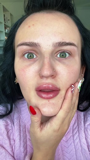 Expert Tips for Flawlessly Covering Acne with Makeup