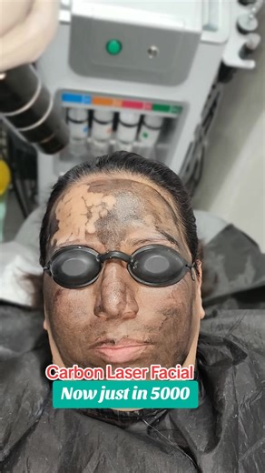 #viral #foruyou #oneplusaesthetic #bestclinic #whiteningdrip