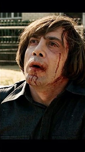 #movie The man got into a car accident and fractured a bone.s