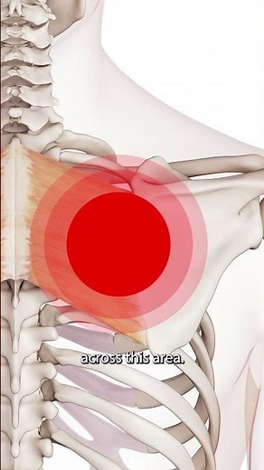 The Rhomboids Trigger Points