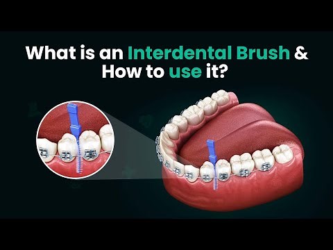 What is an Interdental Brush and How to use it? - 3D Step by Step Guide