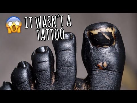 How to Make Your Toes Look Fresh Again | Fast Cleaning!