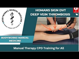Homans Sign for Deep Vein Thrombosis (DVT)