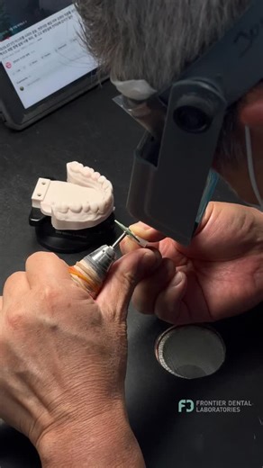 Send us a scan… We’ll handcraft your case. We’ll make you SMILE! | Frontier Dental Laboratories | Facebook