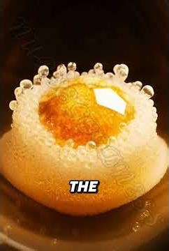 Did you know the gallbladder is a small organ with a big role in digestion?