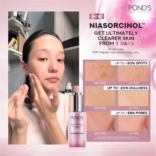 The Pond's Bright Miracle Serum contains revolutionary Niasorcinol for up to 20 layers deep micro repair, allowing you to achieve ultimately clearer skin from 3 days. | POND'S