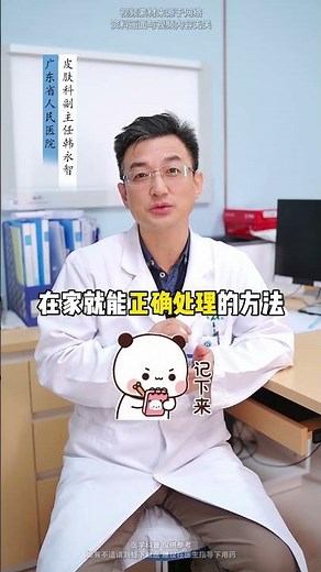 脚上的鸡眼别乱挖，当心是跖疣挖了更严重 #鸡眼 #跖疣 #医生科普 #脚底长硬疙瘩怎么治疗
