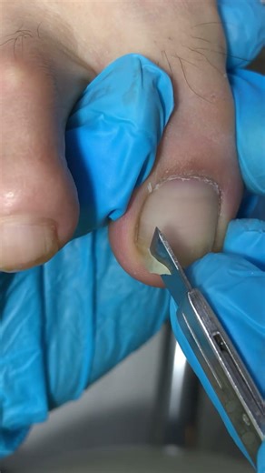 Satisfying Pedicure Video! #pedicure #toenails