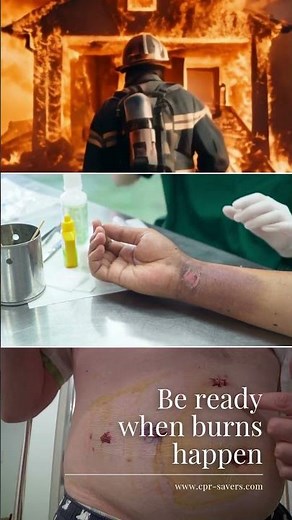 Burn Care | CPR Savers & First Aid Supply, LLC