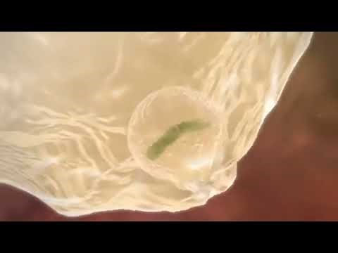 8.6 Lesson 9 White Blood Cell Consuming a Bacteriu