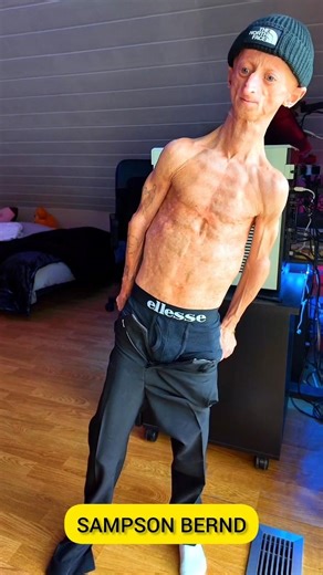 Unbelievable People Who Exist in the Real World 😱 | Rare Humans Explained #facts#amazingfacts#shorts