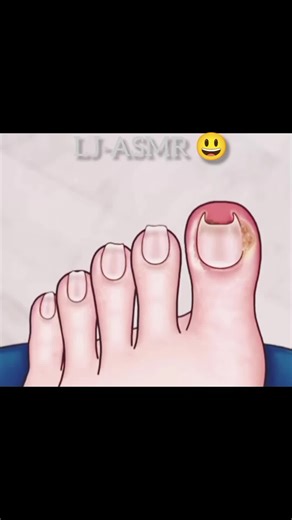 #creatorsearchinsights #asmr #shorts #relaxing #satisfyingvideos #treatment