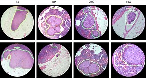 Google's A.I.-Powered AR Microscope Tech Could Fight Cancer