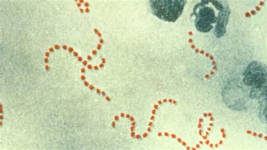 Bactérie streptocoque A: "Il n'y a pas d'inquiétudes à avoir", estiment des médecins