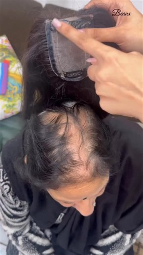 From visible bald spots to seamless coverage in moments. 💙 The Beaux Hair Topper makes instant transformations look natural and effortless. 🦋 (hair exhibition, Delhi events, beauty with confidence, instant glam hair, wig styling, hair topper solutions, confidence boosting hair, Indian hair brand, Delhi beauty scene, style upgrade ideas, hair care essentials, beauty essentials, instant hair fix, grey hair coverage solution, hair powder styling, hair styling hacks, flawless hair look, beauty pro