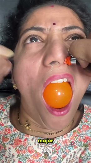 Can sinus problems be treated with a BALLOON?! Sounds fake… but it’s real. #MedicalFacts