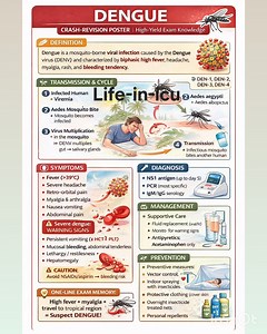 Life-in-icu 👈 follow for more clinical tips ✨️🩺🏥#drarchanasinha #lifeinicu #criticalcare #icudoctor #savealife #stayhealthy #MedicalEducation #respiratorytherapist #emergencymedicine 🩺🏥*Dengue:* - *What:* Mosquito-borne viral 🦠 disease - *Symptoms:* Fever 🥵, rash 🧴, body pain 🤕, headache 🤯 - *Warning signs:* Plasma leakage 🩸, shock 🥶 - *Types:* Dengue fever, DHF, DSS 🚨 - *Manage:* Supportive 🛋️, fluids 💧, monitor 🩺 - *Key:* Platelet count 🩸, hematocrit 📊 | Life-in-icu
