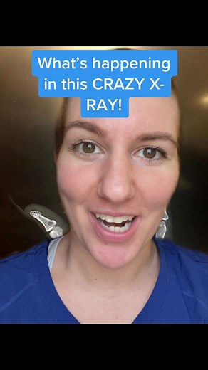 Decoding the Unusual X-Ray Findings