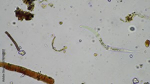 soil nematodes, fungi and microorganisms in a soil and compost sample