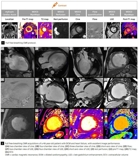 #mri #cmr #magnetomworld #scmr2026 #whycmr #freebreathingcmr #cardiacmri | Antje Hellwich