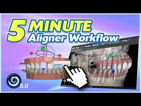 BSPV5.1 How to Plan a Complete Clear Aligner Case in 5 Minutes!