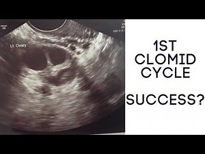 1ST CLOMID CYCLE | SUCCESS? | THE RALLS FAMILY
