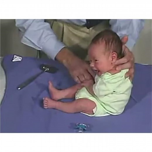 The Moro (Startle) Reflex