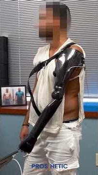 Trans-Humeral Myo-Electric Arm | Prosthetic Innovations x Taska x Steeper