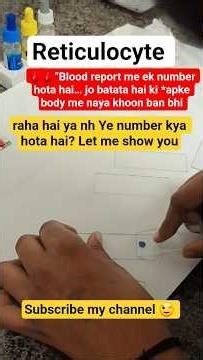 Reticulocyte New RBC 🔥Anemia ka real indicator #shorts #viralvideo #viral #viralshorts #funny #lab