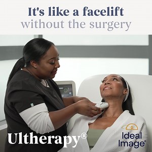 Lift your brow, chin and neck with Ultherapy® this holiday season. Don't wait to give yourself the gift of confidence. Get up to 50% off and save an extra 10% off while it lasts.* Black Friday is on! *Minimum purchase required. See website for full terms. | Ideal Image