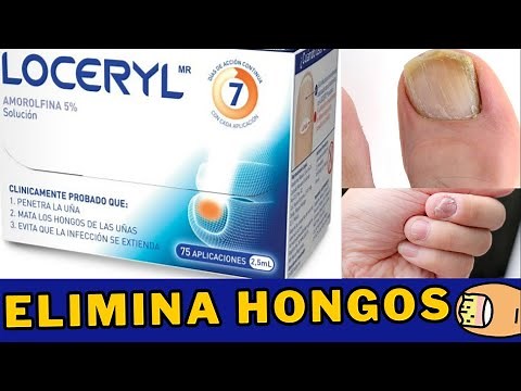 LOCERYL Eliminates Nail Fungus - What it is, how it works and how to apply it