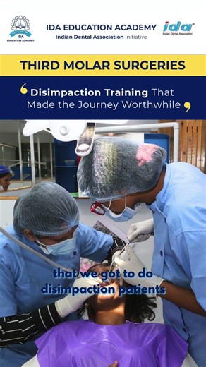 Watching vs Doing: Disimpaction Made Easy