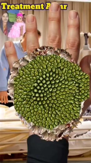 24K views · 111 reactions | Relaxing ASMR video for women's back side hand removal treatment part t | Treatment Asmr | Facebook