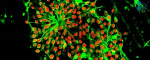 Induced Pluripotent Stem Cells | iPS | iPSCs | hiPSCs