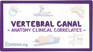 Anatomy clinical correlates: Vertebral canal: Video, Causes, & Meaning | Osmosis