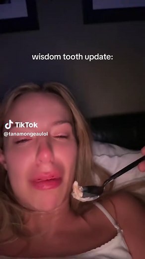 Wisdom Tooth Update: Tana Mongeau Wisdom Teeth Recovery Tips