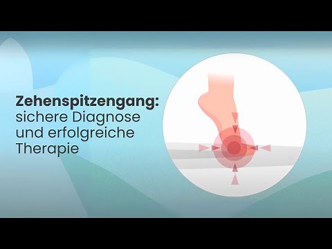 Zehenspitzengang: sichere Diagnose und erfolgreiche Therapie