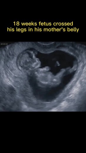 pedicurist on TikTok