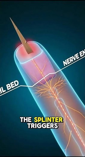 What a Splinter Does Under Your Skin (And Relief)