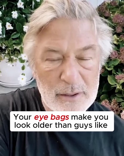 220 reactions · 21 comments | What's REALLY causing your eye bags?...