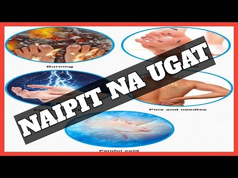 #334 Naipit na Ugat, Pinched Nerve -HERBAL, GAMOT, HOME REMEDY, CURE, TREAT, HOW TO | likas lunas