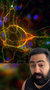 What color are your eyes? 👀 | Dr Karan