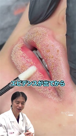 [Plasma Lip Therapy] Be careful not to apply too much plasma! Even Dr. Takashi is surprised by th...