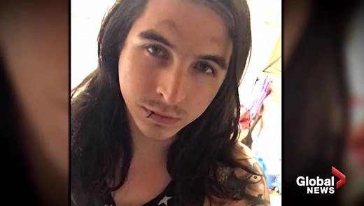 Man dies after vape pen explodes in his face, severing major neck artery - National | Globalnews.ca