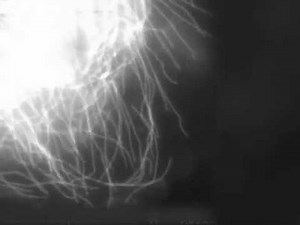 Microtubule Dynamics in vivo