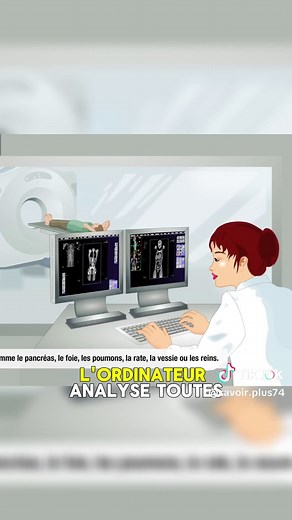 Comment fonctionne un scanner médical ?